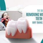 Removing Wisdom Teeth