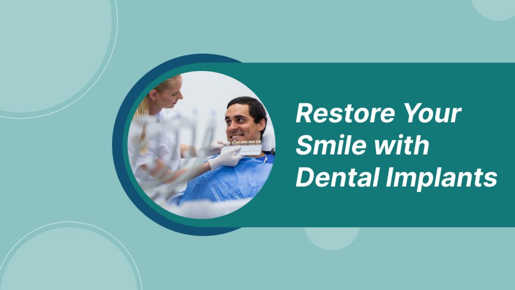 Dental-Implants