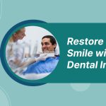 Dental-Implants