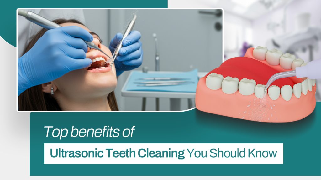 Ultrasonic-Teeth-Cleaning