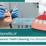 Ultrasonic-Teeth-Cleaning