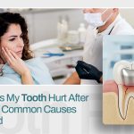 Why-Does-My-Tooth-Hurt-After-a-Filling