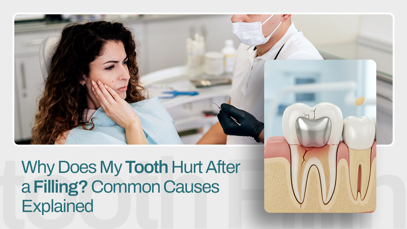 Why-Does-My-Tooth-Hurt-After-a-Filling