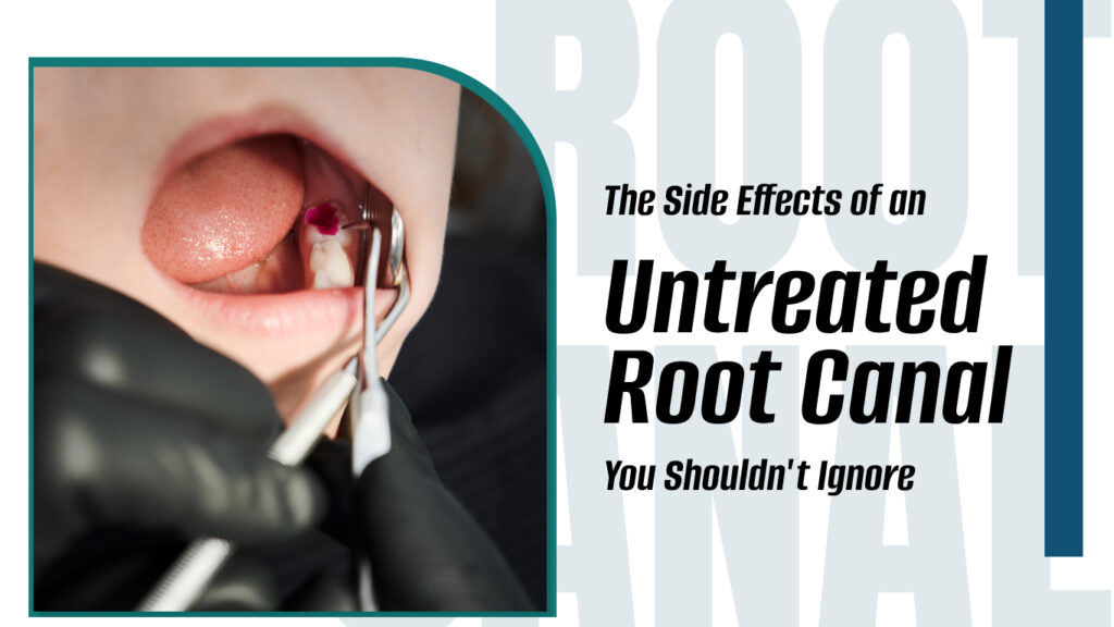 Untreated Root canal