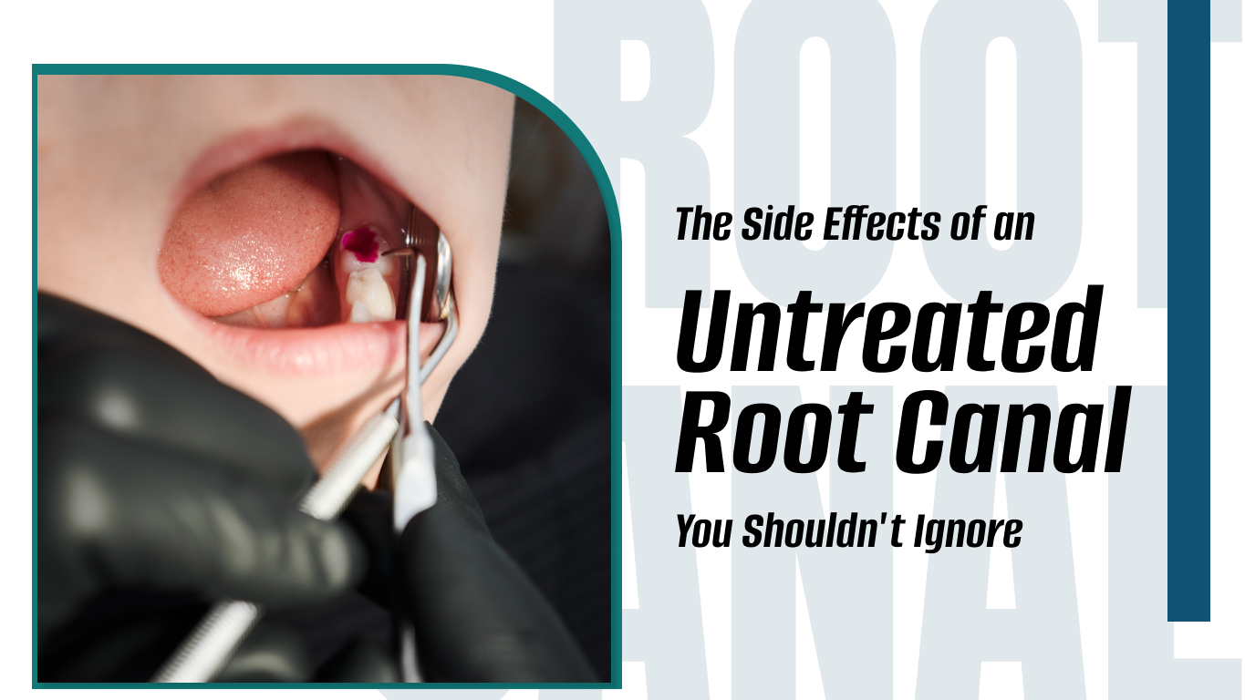 Untreated Root canal