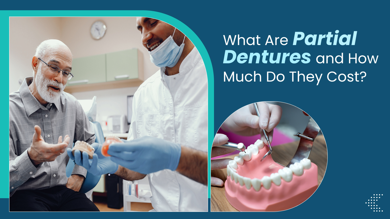 What Are Partial Dentures and How Much Do They Cost