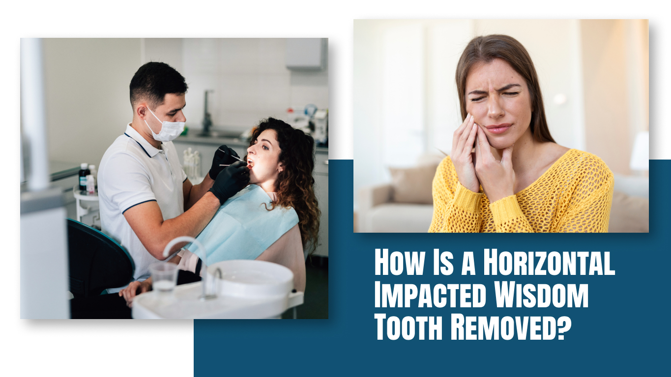 How Is a Horizontal Impacted Wisdom Tooth Removed_